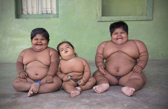 从左到右分别为34公斤重的约吉塔（5岁）、18个月大的幼儿哈什以及48公斤重的安妮莎（3岁）。（网页截图）