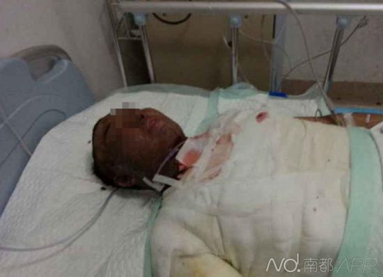 伤者正在接受治疗 伤者正在接受治疗