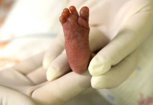 英国男婴出生100分钟后捐器官救活一名成年人