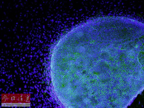 资料图片：由纤维原细胞（深蓝）培养出人体胚胎干细胞（浅蓝）的显微图。新华社路透