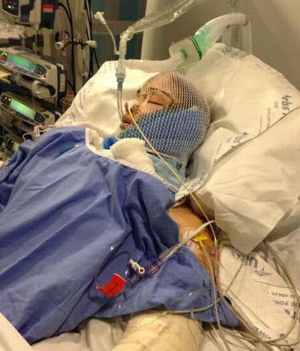 因交通意外撞到一棵树,凯莉不但昏迷长达3星期之久,连右脚最终也因严重受伤需截肢 因交通意外撞到一棵树,凯莉不但昏迷长达3星期之久,连右脚最终也因严重受伤需截肢