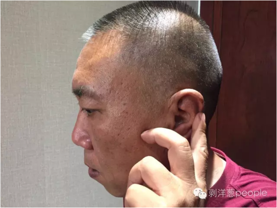 53岁的王金虎，按着自己耳朵上的伤痕。那是送走他时父母留下的。