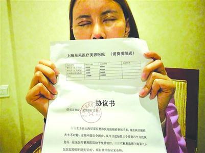 手术后，刘娜（化名）的眼睛出现了“大小不对称，左眼不能完全闭合”的情况。　/晨报记者　张佳琪