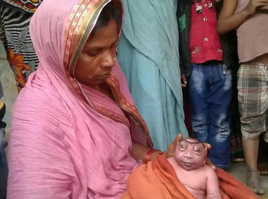 印度女子日前生下一个”无脑怪婴“。