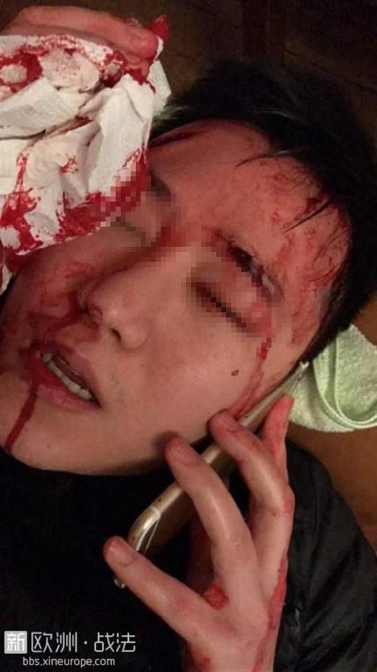 华人被打，满脸是血。图片来源：新欧洲·战法