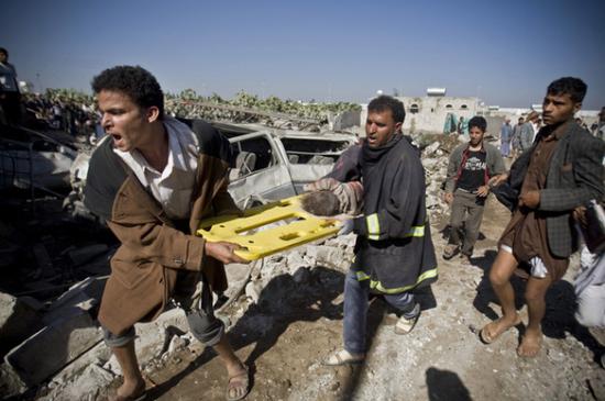  资料图：也门，从废墟中抢救出的儿童。