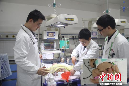 近日，江西省儿童医院为一名刚出生两天的16斤巨婴完成了9斤骶尾部巨大崎胎瘤切除手术。院方供图