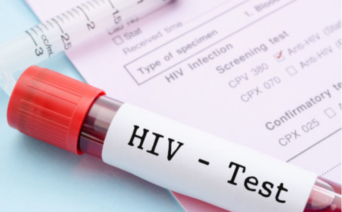 全球135个国家的HIV自检价格将减半