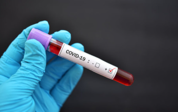 南非国家传染病研究所-9个省份的COVID-19感染都出现了复苏迹象