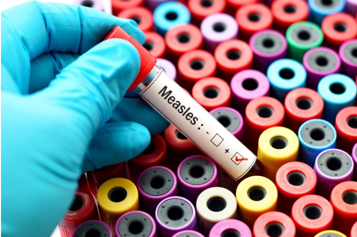豪登省报告了4例麻疹病例