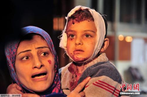 11 战火中的叙利亚母子。