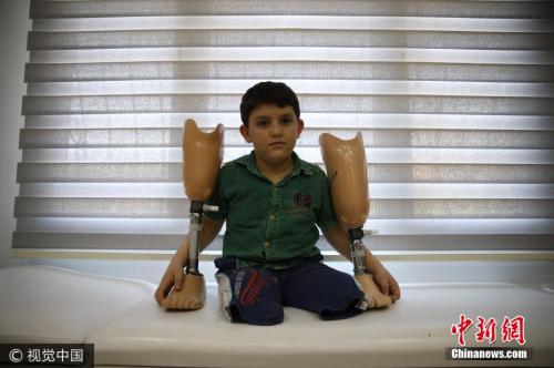 叙利亚10岁儿童空袭中失去双腿。图片来源：视觉中国。